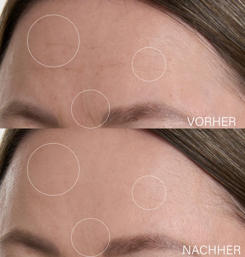Botanical Lifting Effect Serum